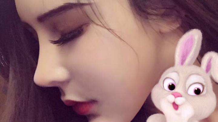 面部吸脂失败,术后凹凸不平怎么修复