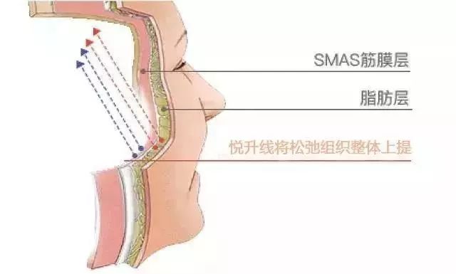 全国爱眼日,上海美莱眼部整形专家团倡导护眼健康