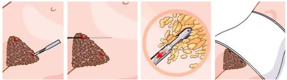 上海美莱来院路线