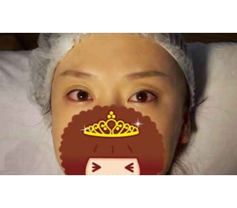 上海美莱隐形矫正黑科技iTero体验a开放