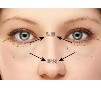 美莱口腔医生周茹获得中国区“500+例隐适美病例”奖杯