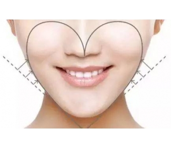 上海美莱袁玉坤多维多立体吸脂案例