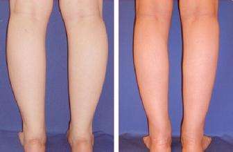 美莱集团院长峰会召开，33家美莱医院院长齐聚蓉城