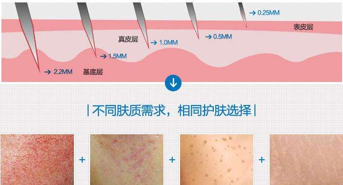 自体软骨隆鼻专家李6月坐诊<a href='/' target='_blank'><u>上海美莱</u></a>