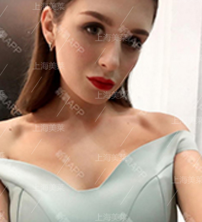 自体软骨隆鼻专家李6月坐诊上海美莱