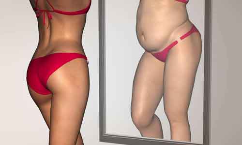 上海哪家医院做双眼皮手术效果自然