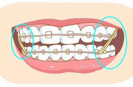 上海哪家医院做双眼皮手术效果自然