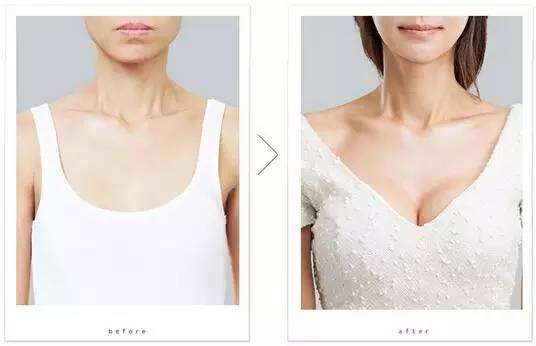 严重掉发,发际线还后移怎么办