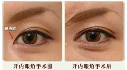 上海美莱6月半较久专家金智勋坐诊