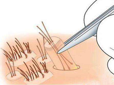 有什么方法可以瘦腿