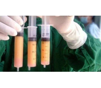 用什么方法能快速美白