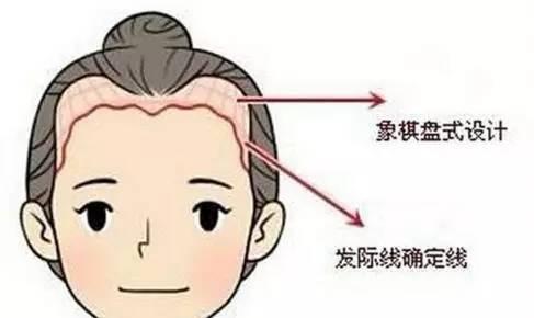 上海冰点脱毛的医院哪家好