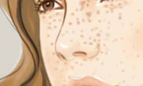 上海美莱承办的全国乳房整形美容“百里挑医·创造弧度”