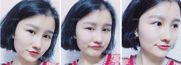 注射水光针补水效果真的好吗