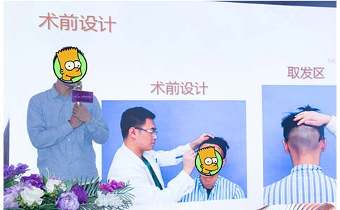 上海美莱揭秘,悦升线摩洛哥皇室的抗衰秘密