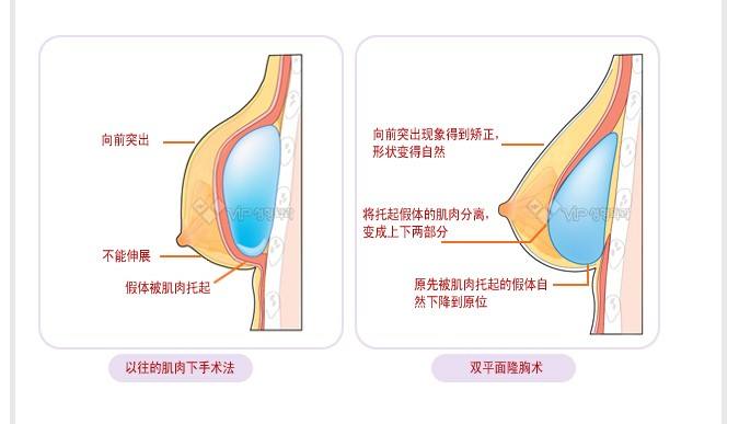 皮肤暗黄怎么办,水光针有效吗