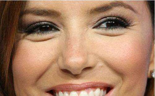 眼袋越来越严重了怎么去除