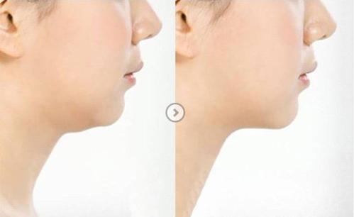 <a href='/' target='_blank'><u>上海美莱</u></a>联手姣兰玻尿酸举办“千娇百媚”活动