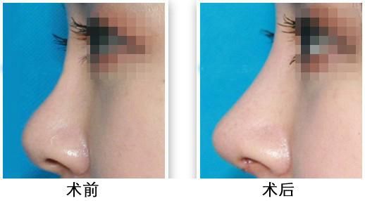 上海美莱联手姣兰玻尿酸举办“千娇百媚”活动