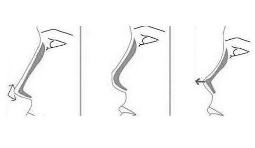 上海美莱定制暑假整形避坑指南