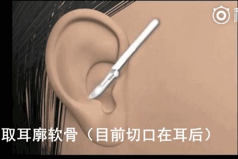 上海美莱定制暑假整形避坑指南