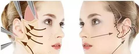 什么方法减肥又快又有效