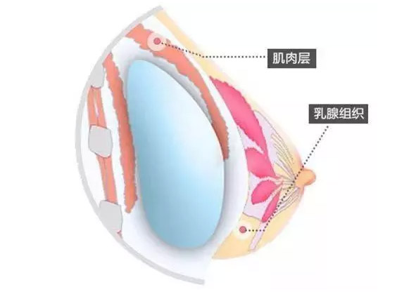 美莱集团院长齐聚广州美莱参加整形修复技术峰会
