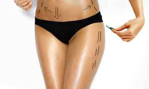 上海美莱悦升线线雕除皱,明星年轻的秘密