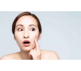 <a href='/' target='_blank'><u>上海美莱</u></a>激光去黑头效果怎么样