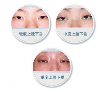 腰很粗肚子上有很多肉怎么瘦下来