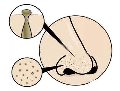 腰很粗肚子上有很多肉怎么瘦下来
