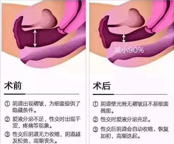 上海美莱韩式半较久定妆效果不好