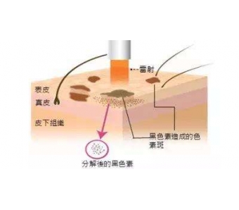 上海美莱纹绣师医生