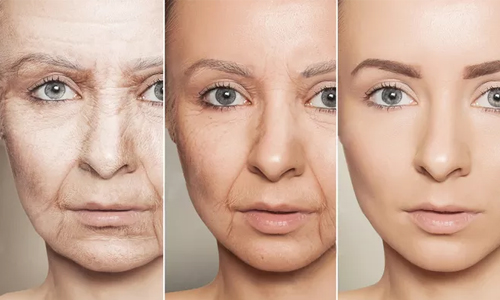 美莱祛斑效果怎么样