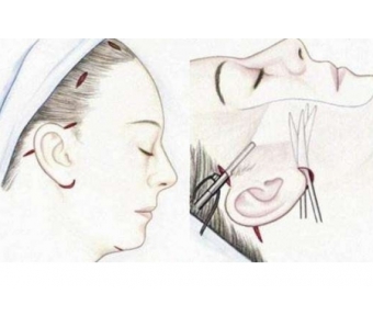 怎么才能可以去除脸上的斑点