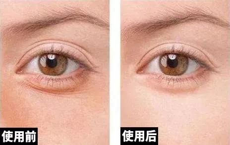 上海美莱私密整形让你自信做辣妈