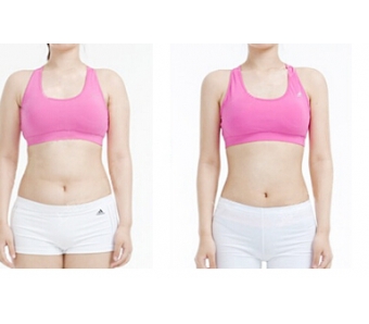 上海私密整形医院哪里比较好