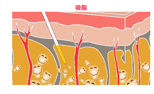 女性私密整形医院哪家好