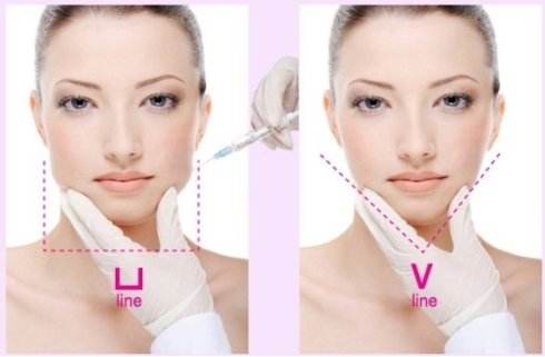 上海美莱菲密丽私密整形,遇见幸福时刻