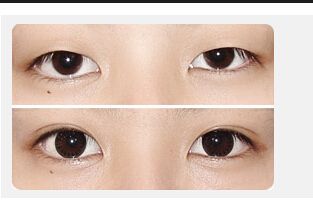 <a href='/' target='_blank'><u>上海美莱</u></a>口腔矫正嘉年华,牙齿矫正立减1200