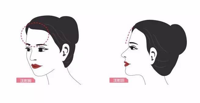 上海美莱口腔矫正嘉年华,牙齿矫正立减1200