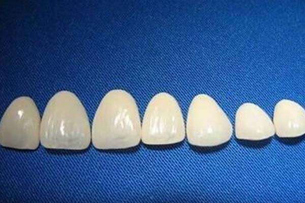 上海美莱口腔矫正嘉年华,牙齿矫正立减1200