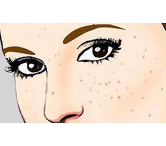 上海私密整形医院哪家比较正规