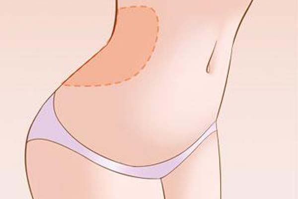 上海美莱整形医院是正规的吗