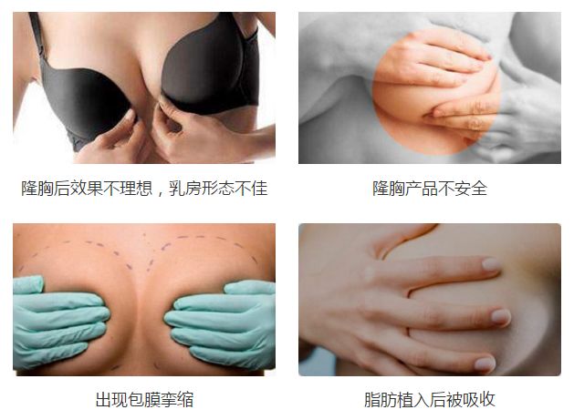 上海美莱整形医院是正规的吗