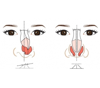 上海美莱整形医院是正规的吗