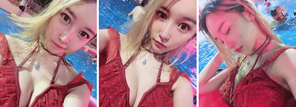 内窥镜丰胸的效果怎么样