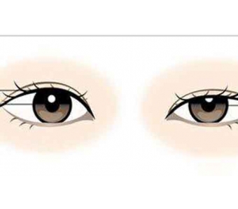 内窥镜丰胸的效果怎么样