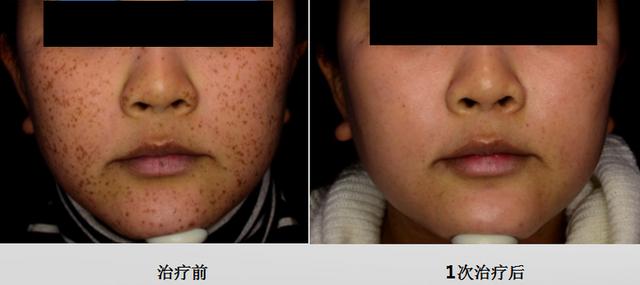 上海美莱吴淑琴医生