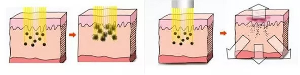 上海美莱隆胸怎么样